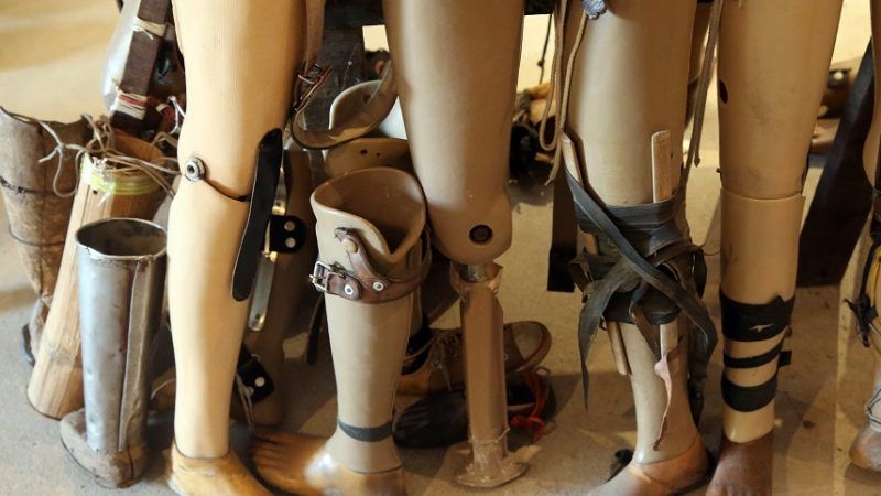 இலவச செயற்கை கால்கள் முடநீக்கு சாதனங்கள் பொருத்தும் முகாம் - முடநீக்கு சாதனங்கள் பொருத்தும் முகாம்